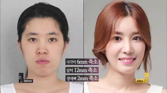 렛미인 이미지