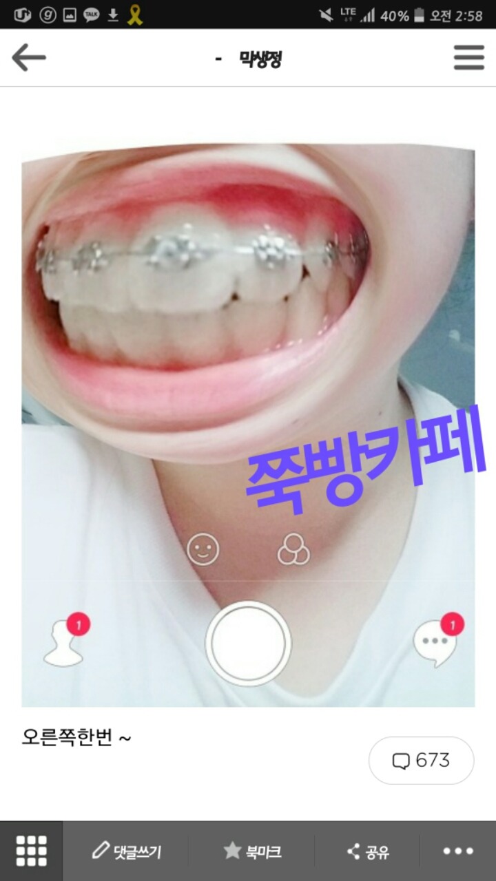 막생정에 올라온 치아에 낀 음식 확인할때 (배꼽주의) | 인스티즈