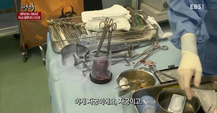 난소암은 정말 무서운 암입니다.jpg | 인스티즈