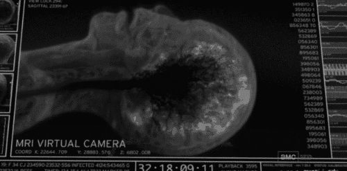 죽기직전의 뇌 mri | 인스티즈