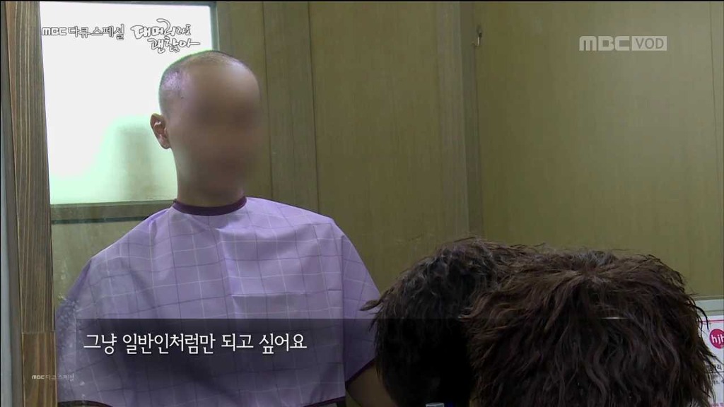 탈모 환자가 받는 스트레스... | 인스티즈