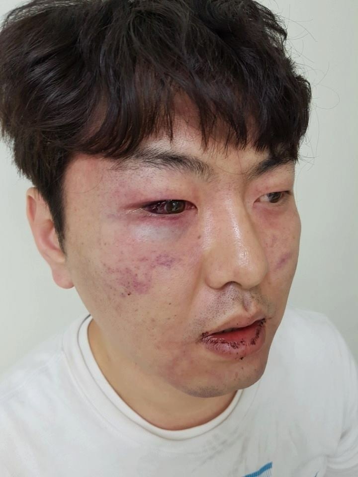 보이스피싱 용의자로 오인하고 일반인 폭행한 경찰들 (피해자분 사진 있음) | 인스티즈