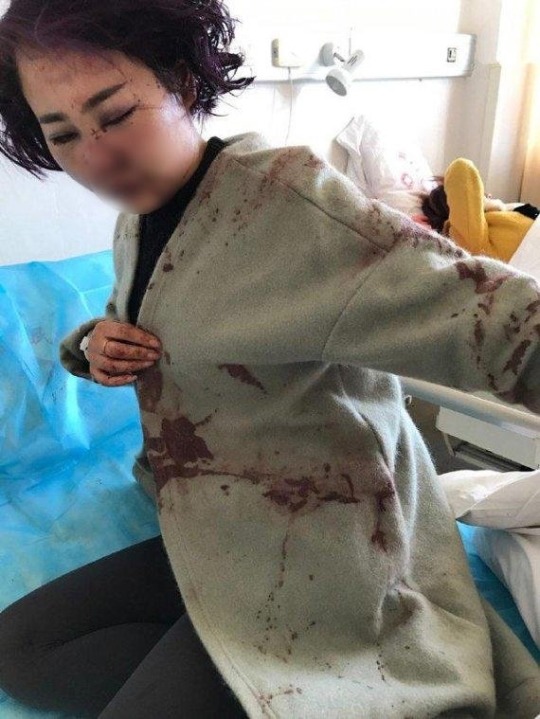 중국서 여성 관광객 무차별 폭행.. 사건 은폐한 경찰에 공분 | 인스티즈