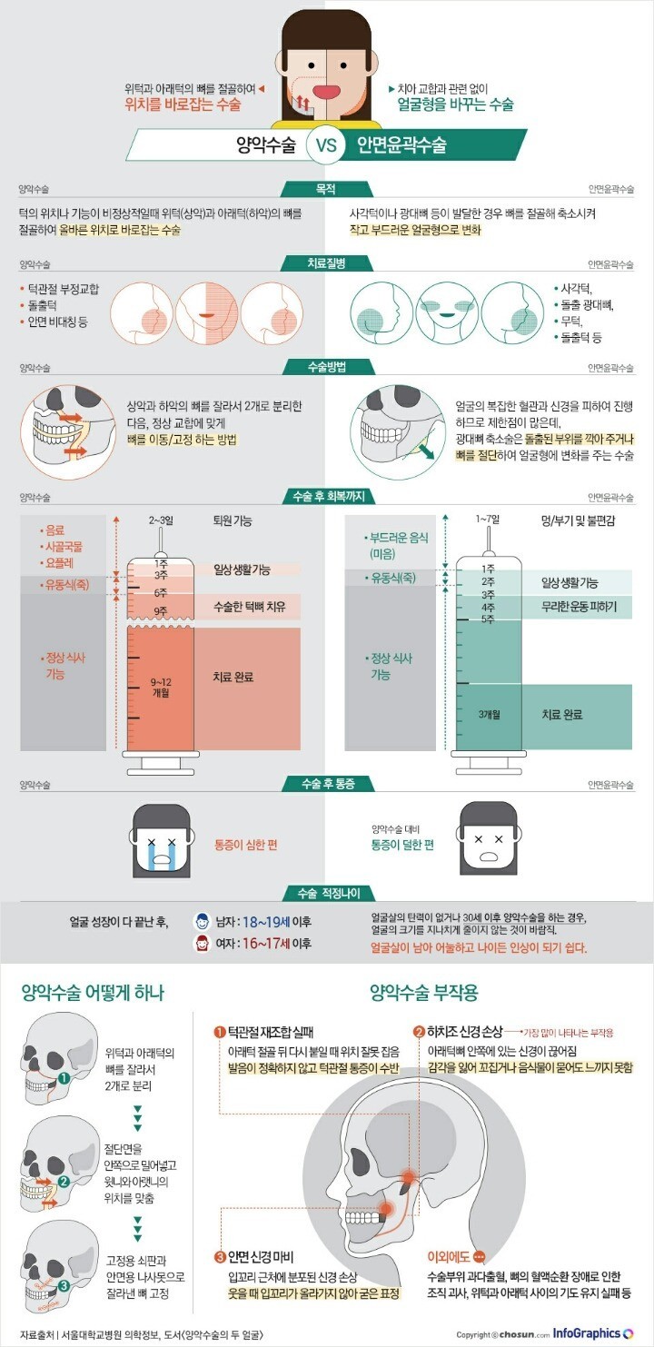 양악수술 vs 안면윤각수술 | 인스티즈