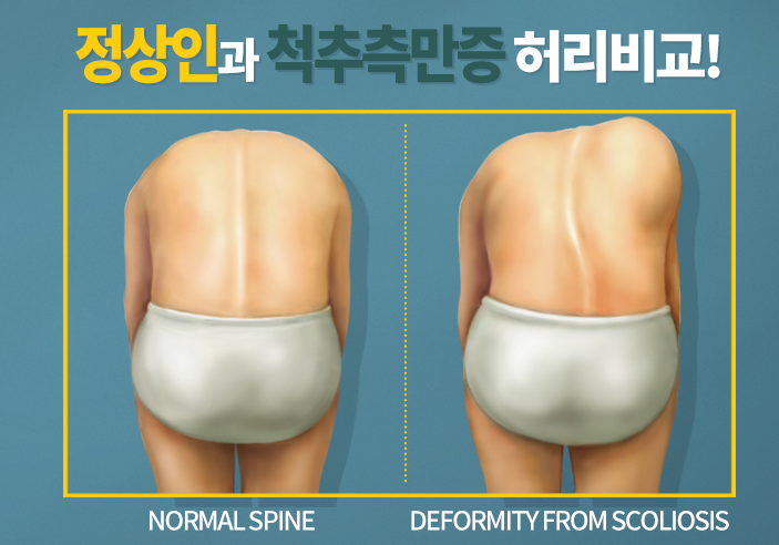 현대인이 많이 앓고 있는 질병중의 하나 | 인스티즈