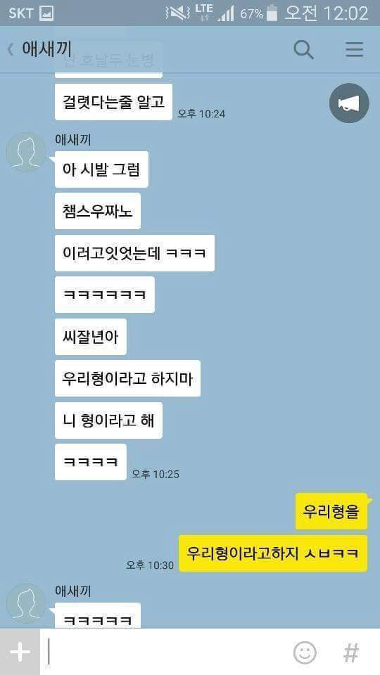 눈병걸린 우리형.jpg | 인스티즈