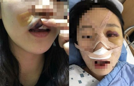 “경호학과 남학생들에게 집단 폭행” 여학생 글 논란… 경찰 “조사 중” | 인스티즈