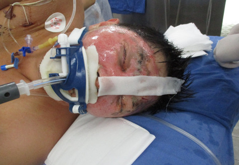 안녕하세요 저는 자주포사고 부상자 이찬호입니다. (사진 꼭 주의하고 들어와) | 인스티즈