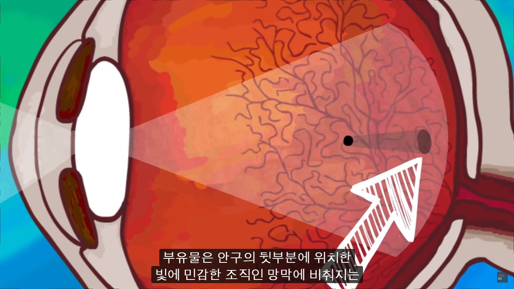 여러분의 눈에 둥둥 떠다니는 그것들은 무엇일까요? | 인스티즈